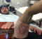 Australian Man Recovering From Severe Burns After iPhone 6 Reportedly Explodes