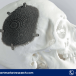 Cranial Implants Market