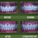 Gum lightening service